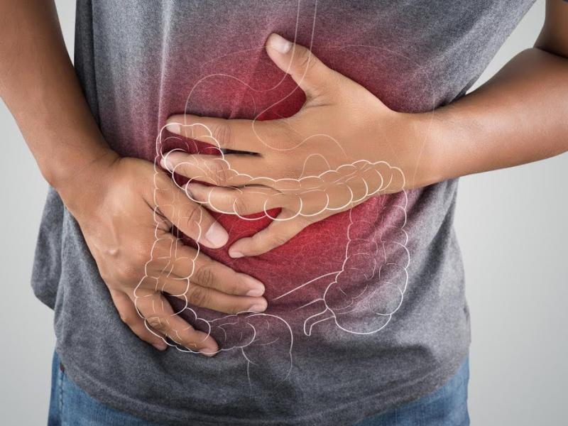  геморроя и синдрома раздраженного кишечника
