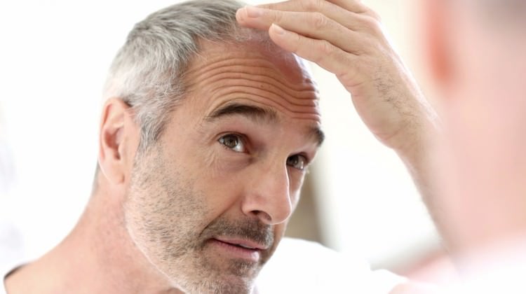 Дифузний вид характеризується тим, що щодня чоловік втрачає до 100 волосин
