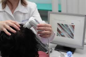 Інтенсивне випадання волосся може спостерігатися в двох випадках - внаслідок генетичної схильності організму, викликає інтенсивну вироблення дигидротестостерона, і через зовнішніх факторів